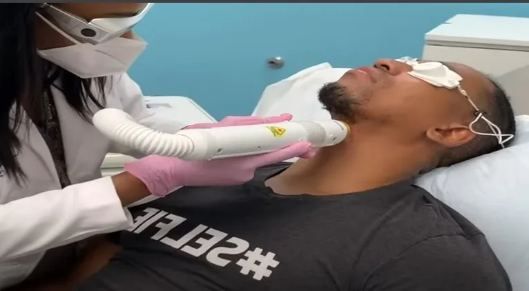 Efeitos adversos da depilação a laser